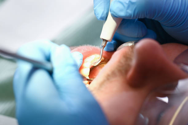 Best Same-Day Emergency Dentist in Cloverdale, CA