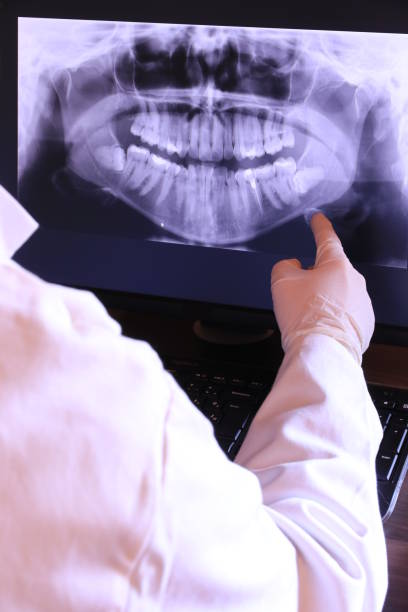 Best Emergency Tooth Extraction in Cloverdale, CA