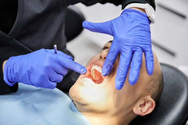 Best Emergency Treatment for Toothache in Cloverdale, CA