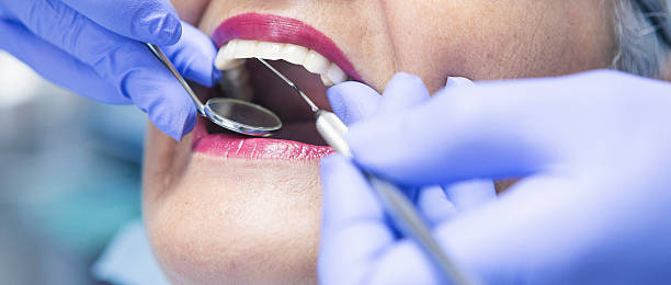 Best Emergency Tooth Extraction in Cloverdale, CA